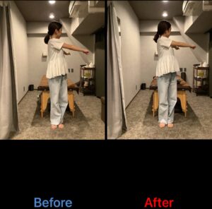 体幹のひねり動作のBefore/After比較。背部の緊張が緩み、体幹回旋の関節可動域が向上。