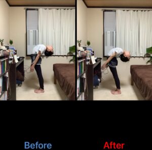 胸を反る動作のBefore/After比較。施術後は胸椎伸展の関節可動域が広がり、反りやすい。